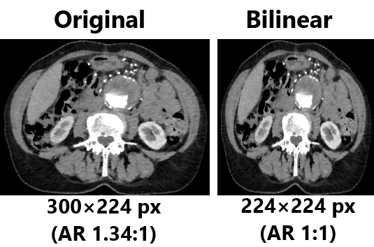 Original 300×224 vs bilinear 224×224 comparison