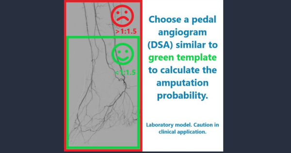 AI for limb salvage prediction