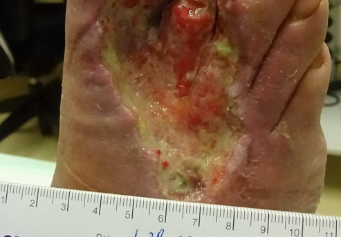 Baseline clinical photo