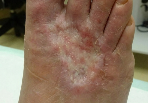 Follow-up image (illustrative)