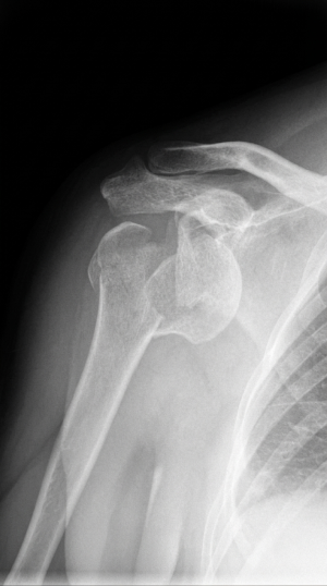 After: clean radiology frame