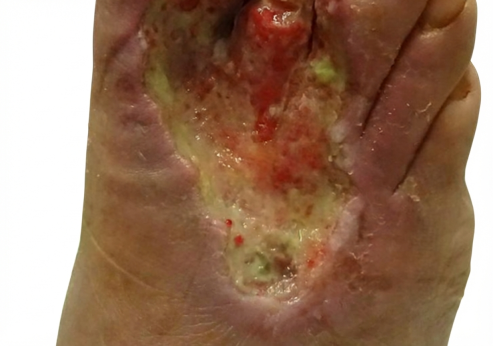 After: dataset-ready macroscopy