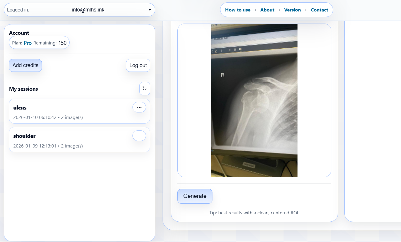 Step 3 — Generating progress